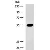 兔抗CX3CR1多克隆抗体