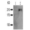 兔抗BCR(Phospho-Tyr177)多克隆抗体