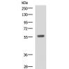兔抗CYP4A11多克隆抗体 