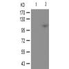 兔抗BRAF(Phospho-Ser446)多克隆抗体