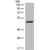 兔抗DCP2多克隆抗体