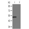 兔抗CAMK2B/G/D(Phospho-Thr287)多克隆抗体