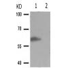 兔抗CAMK4(Phospho-Thr196/200) 多克隆抗体