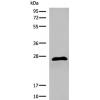 兔抗DGCR6多克隆抗体