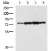 兔抗CAPN6多克隆抗体