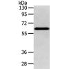 兔抗DHCR24多克隆抗体