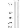 兔抗CARM1(Phospho-Ser228)多克隆抗体