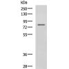 兔抗DHX58多克隆抗体