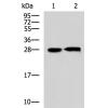 兔抗CCDC134多克隆抗体