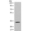 兔抗CCDC137多克隆抗体