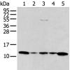 兔抗CCL1多克隆抗体