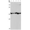 兔抗DNAJB4多克隆抗体