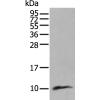 兔抗CCL18多克隆抗体