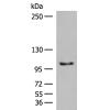 兔抗CDH1多克隆抗体