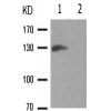 兔抗CDH5(Phospho-Tyr731)多克隆抗体