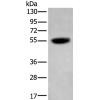 兔抗CDK14多克隆抗体
