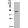 兔抗CDK18多克隆抗体