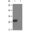 兔抗CDKN1B(Phospho-Thr198)多克隆抗体