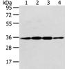 兔抗CDX2多克隆抗体