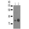 兔抗EZR(Phospho-Thr567)多克隆抗体  
