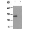 兔抗FANCD2(Phospho-Ser222)多克隆抗体