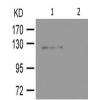 兔抗FGFR1(Phospho-Tyr654)多克隆抗体