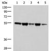 兔抗FKBP5多克隆抗体  
