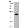 兔抗GNAT1多克隆抗体