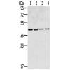 兔抗GPR15多克隆抗体