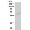 兔抗MBTPS2多克隆抗体