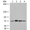 兔抗MCCC1多克隆抗体