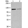 兔抗MCM9多克隆抗体