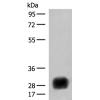 兔抗HLA-DRB4多克隆抗体