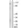 兔抗GAB2(Phospho-Ser159) 多克隆抗体 