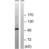 兔抗MERTKTYRO3(Phospho-Tyr749681) 多克隆抗体