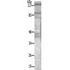 兔抗MET(Ab-1003) 多克隆抗体