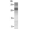 兔抗MET(Ab-1234) 多克隆抗体