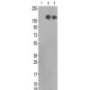 兔抗MET(Ab-1313) 多克隆抗体