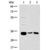 兔抗MLF1多克隆抗体