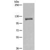 兔抗MLLT10多克隆抗体