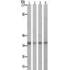  兔抗HNRNPD(Ab-83) 多克隆抗体 