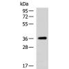 兔抗GALR3多克隆抗体 