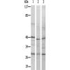 兔抗MRPL10多克隆抗体
