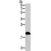 兔抗MRPL12多克隆抗体
