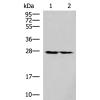 兔抗MRPL16多克隆抗体