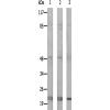 兔抗MRPL32多克隆抗体