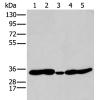  兔抗HOXC11多克隆抗体 