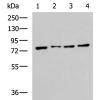 兔抗HSPA5多克隆抗体