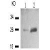 兔抗HSPB1 (Phospho-Ser15) 多克隆抗体