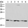 兔抗TRMT112多克隆抗体   